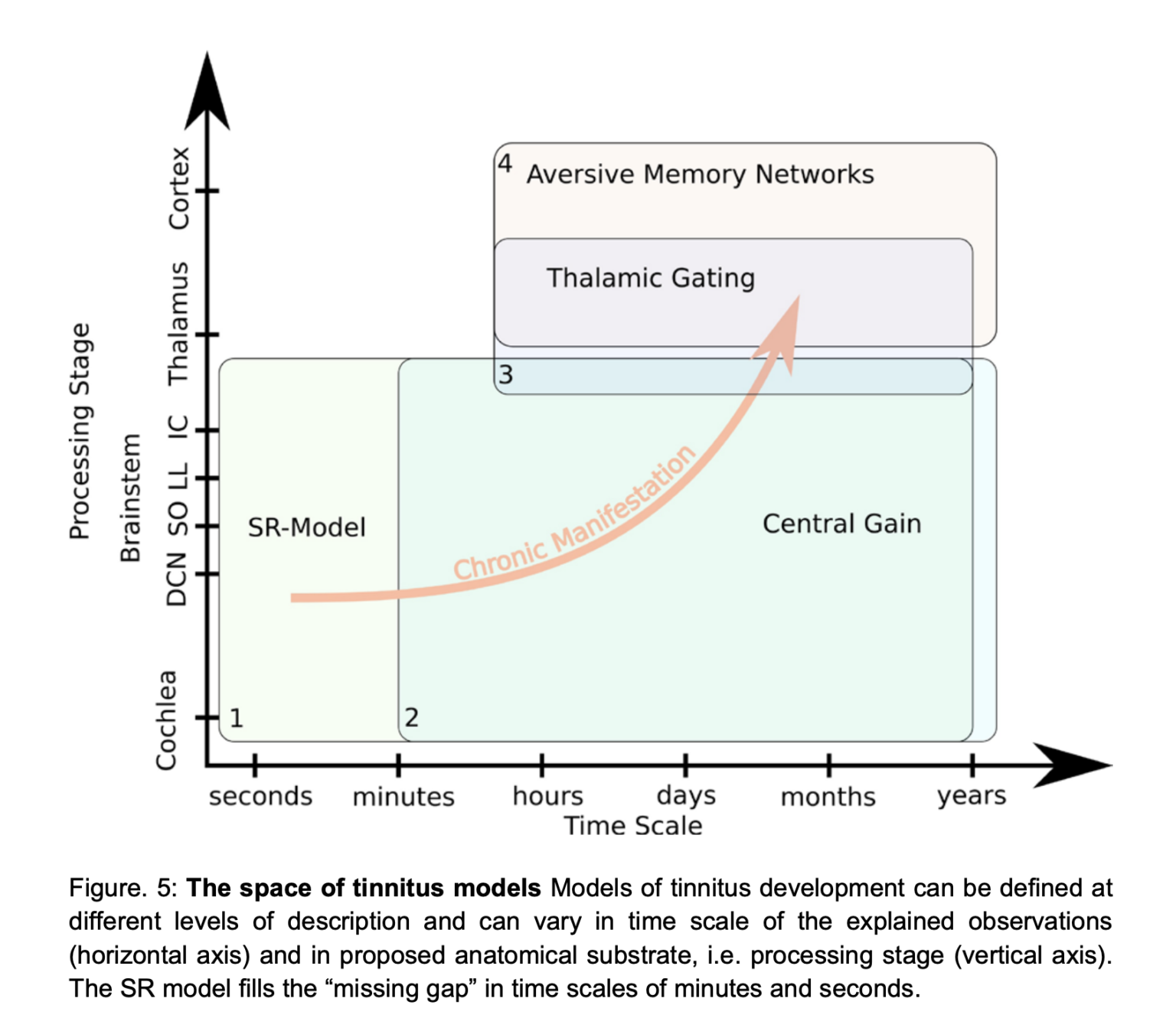 Tinnitus Research Spotlight A unified explanation of tinnitus